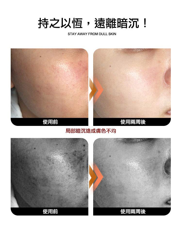 (預購3-4週)🇹🇼Truu童: 24.5強效左型C美白安瓶【斑點特攻隊】