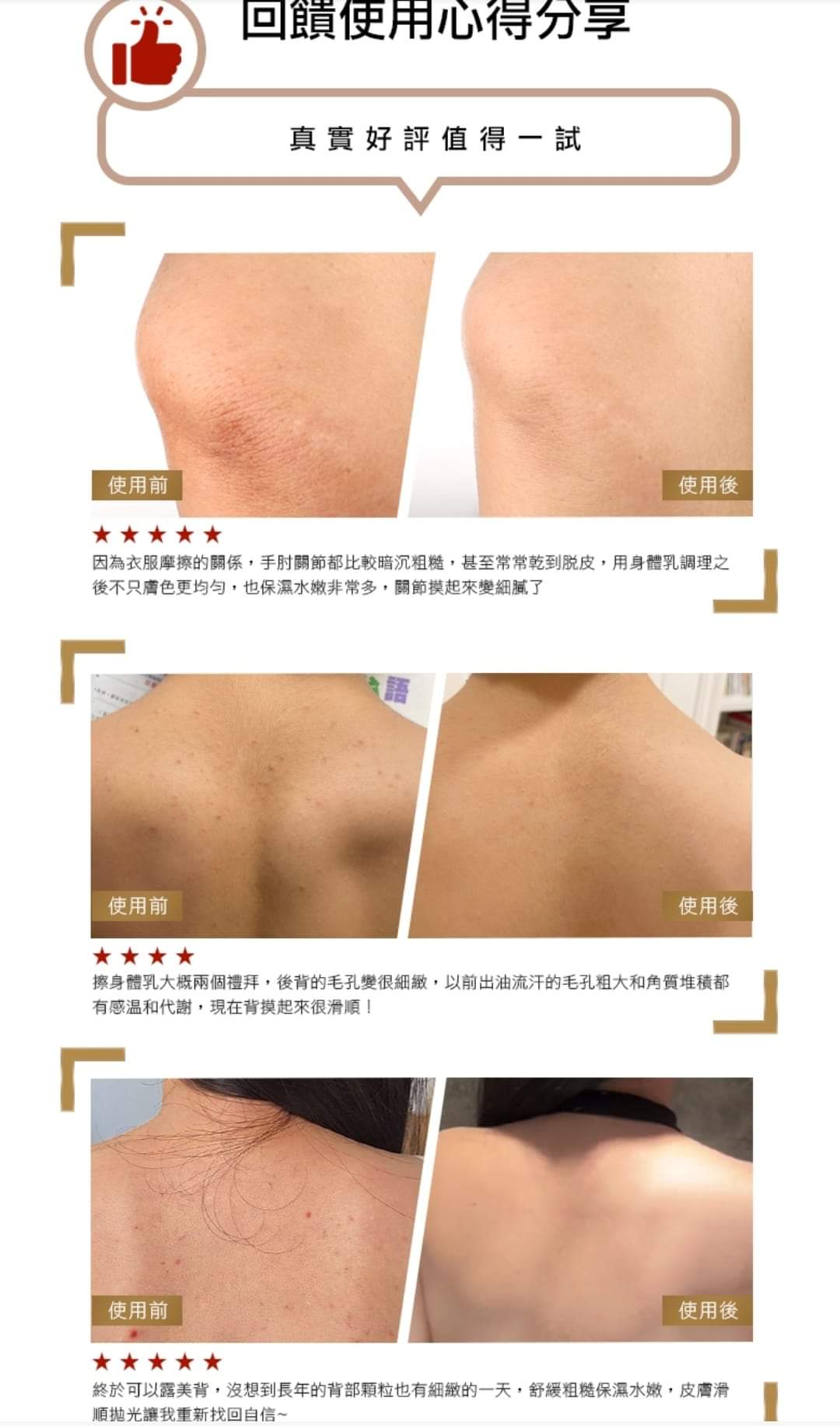 (預購3-4週)🇹🇼TRUU童-76酵母水楊酸身體乳